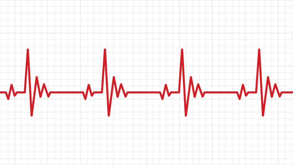 Heartbeat On Graph Paper